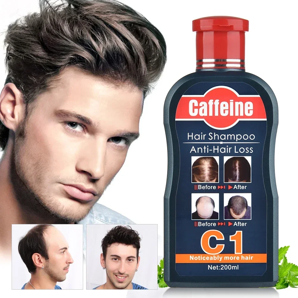Hair Care Korean Products - Мужской шампунь для роста волос, натуральные