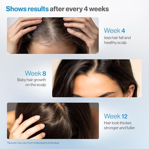 Премиум-сыворотка с розмарином – обзор и цена Hair Care For Hair Fall