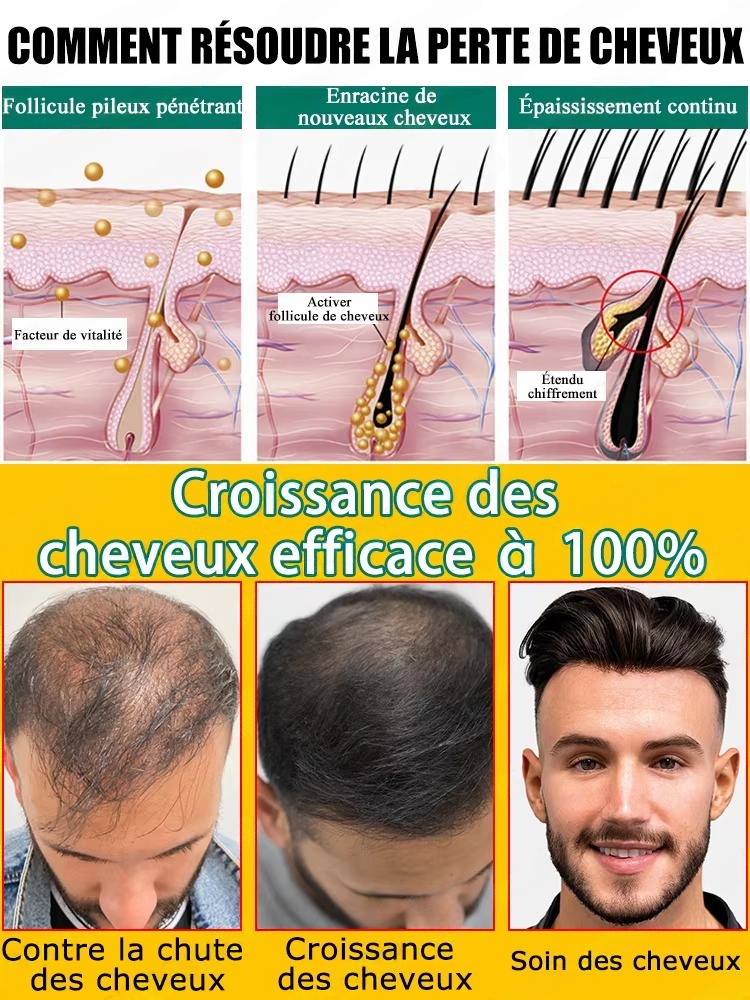 Ежедневный имбирный уход для к – обзор и цена Hair Care For Hair Fall