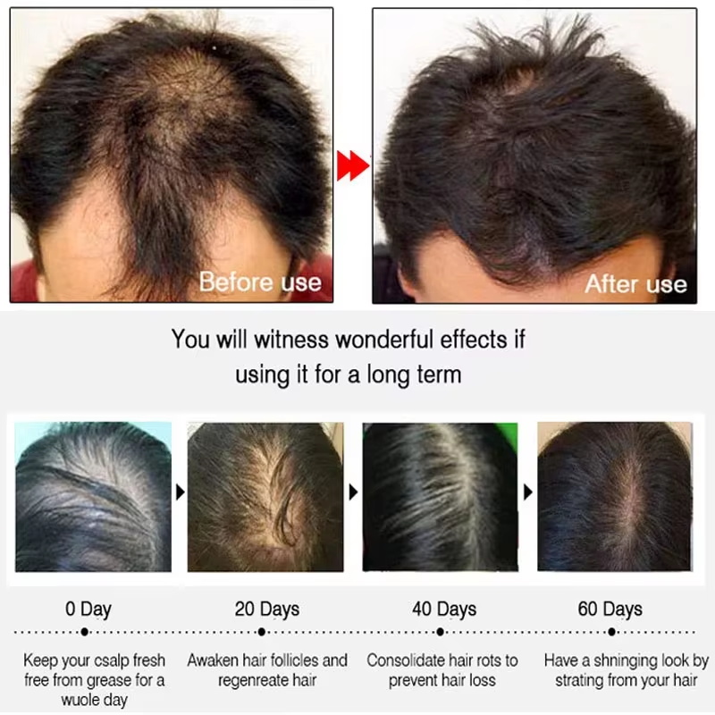 Спрей для быстрого роста волос – обзор и цена Hair Care Hair Serum
