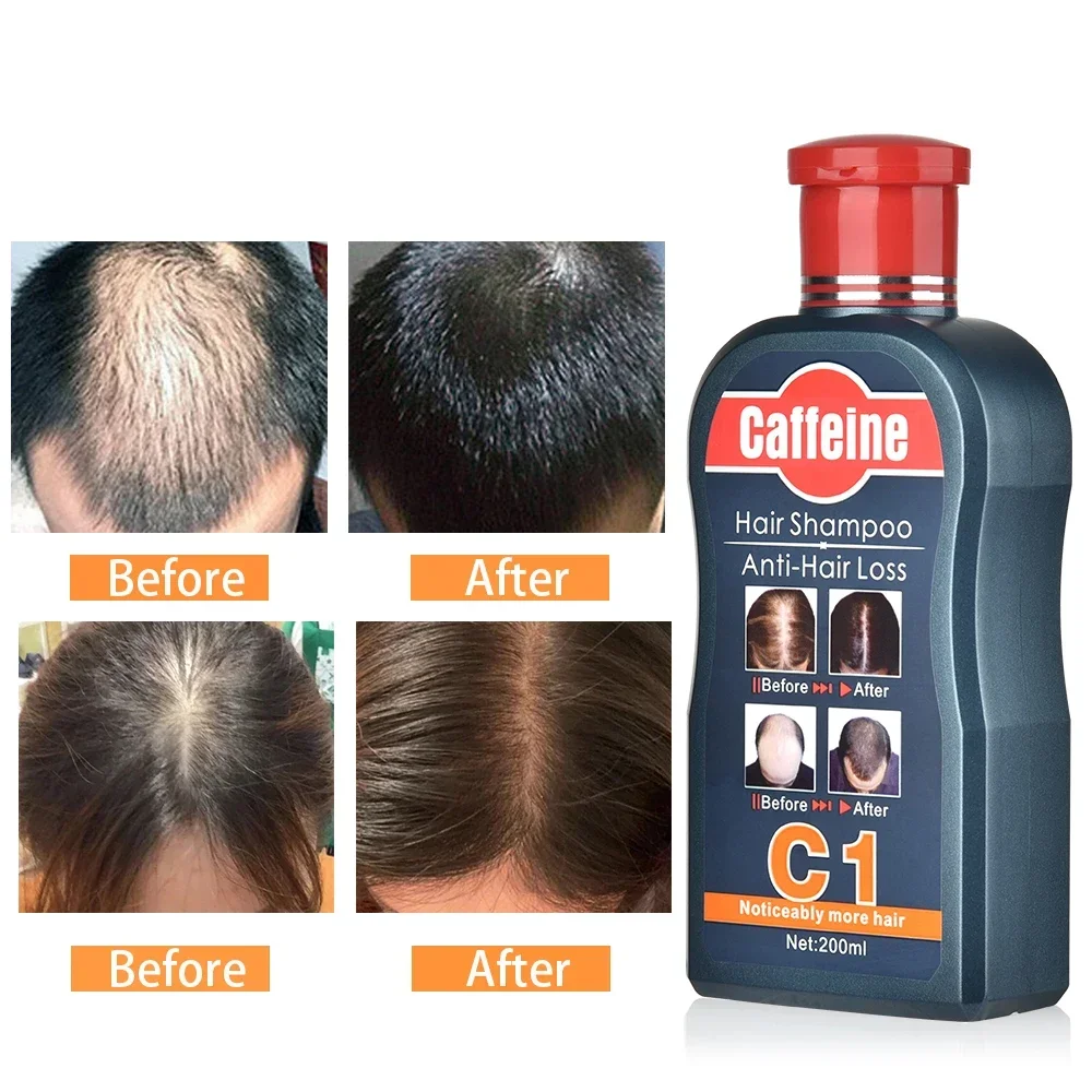Мужской шампунь для роста воло – обзор и цена Hair Care Korean Products